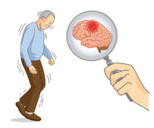 best-parkinsons-services-attapur